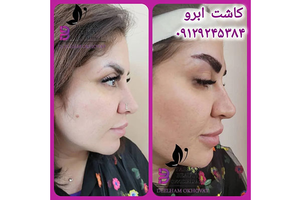 مرکز زیبایی و جوانسازی پارسیان بیوتی