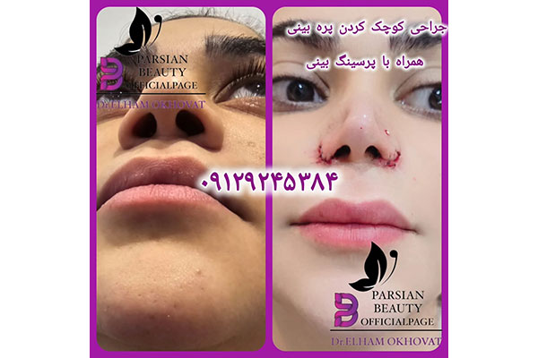 مرکز زیبایی و جوانسازی پارسیان بیوتی