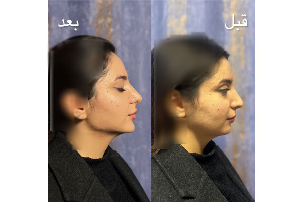 تفاوت تکنیک MD Code با تکنیک‌های قدیمی