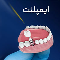 ایمپلنت دندان - مرکز دندانپزشکی هومینا - شعبه سعادت آباد