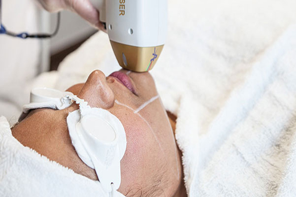 تصویر لیزر مو های زائد - کلینیک زیبایی نوران