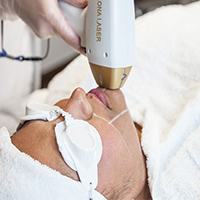 لیزر مو های زائد - کلینیک زیبایی نوران