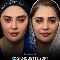 لیفت ترکیبی صورت با فیلر و نخ - دکتر سجاد نعمتی