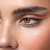 تزریق بوتاکس توسط دکتر سجاد نعمتی