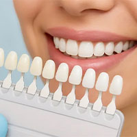 کامپوزیت اقساط ۵ ماهه بدون بهره
