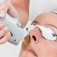 لیزر موهای زائد - دکتر پونه یزدانی - مطب تخصصی پوست، مو و زیبایی و لیزر 