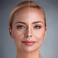 جراحی زیبایی - دکتر پونه یزدانی - مطب تخصصی پوست، مو و زیبایی و لیزر