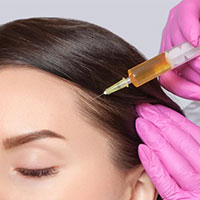 تزریق هیر فیلر -  دکتر پونه یزدانی - متخصص پوست، مو و زیبایی و لیزر