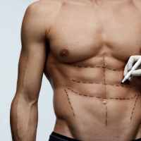 جراحی لیپوماتیک 360 درجه -  پارسیان بیوتی - مرکز زیبایی، جراحی و جوانسازی