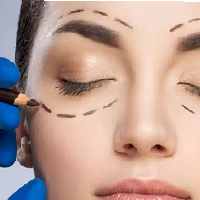 جراحی بلفاروپلاستی -  کلینیک زیبایی رزیبا