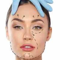 لیفت و جوانسازی صورت با نخ -  کلینیک زیبایی رزیبا 