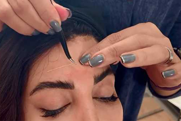 تصویر نخهای کلاژن و جوانساز - کلینیک فوق تخصصی کاشت مو و ابرو نیک رویش