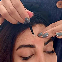 نخهای کلاژن و جوانساز - کلینیک فوق تخصصی کاشت مو و ابرو نیک رویش